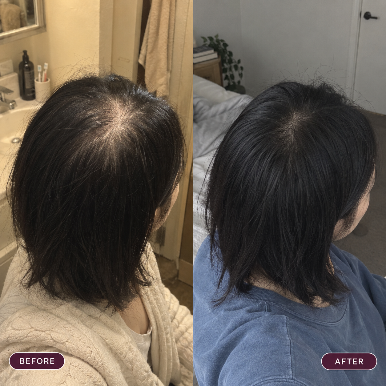 Customer-submitted before and after image showing a crown with less scalp show-through