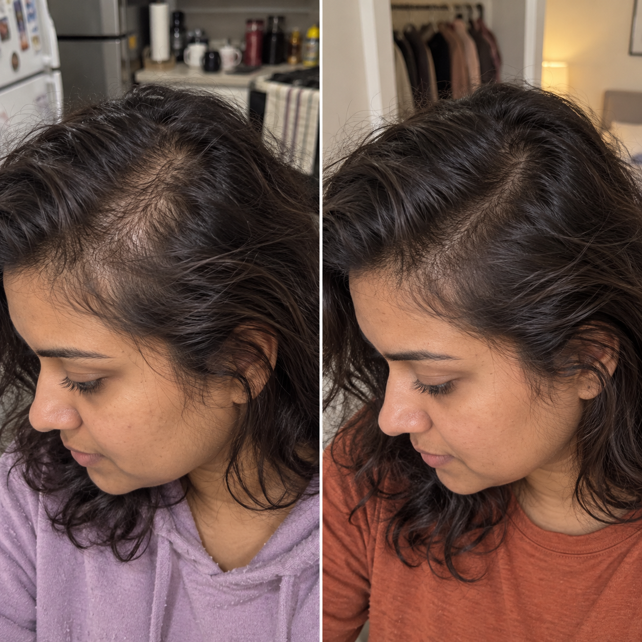 Customer-submitted before and after image showing a crown comparison
