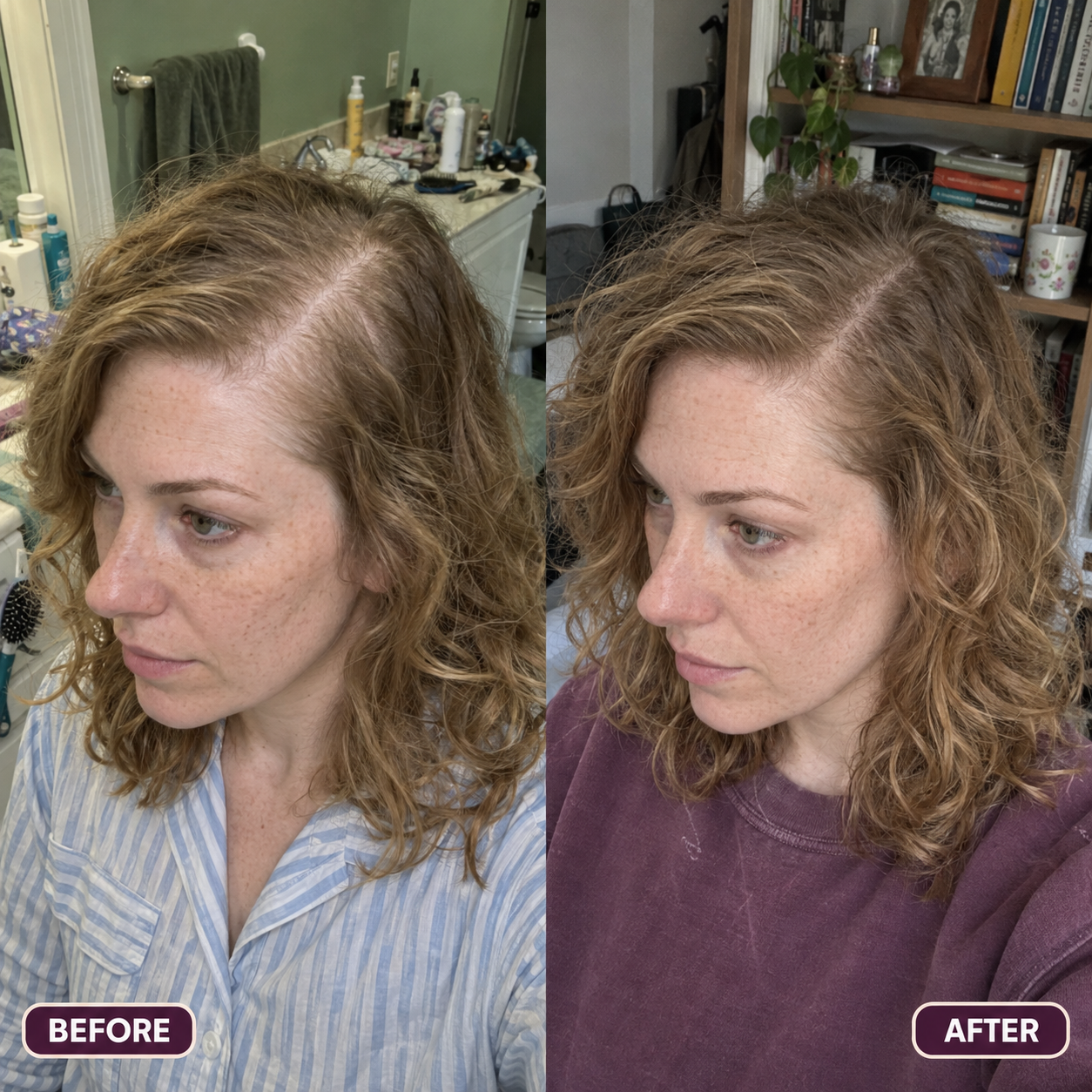 Customer-submitted before and after image showing a fuller-looking hairline and density